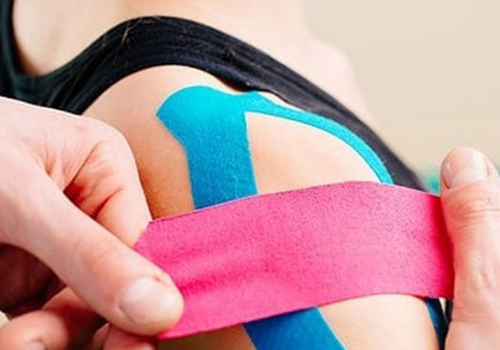Kinesiology taping