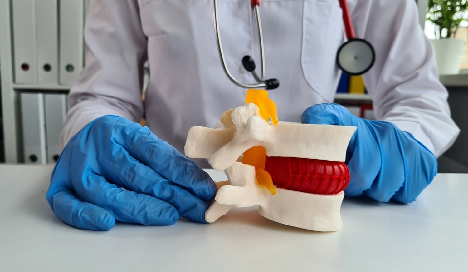 Lumbar Canal Stenosis